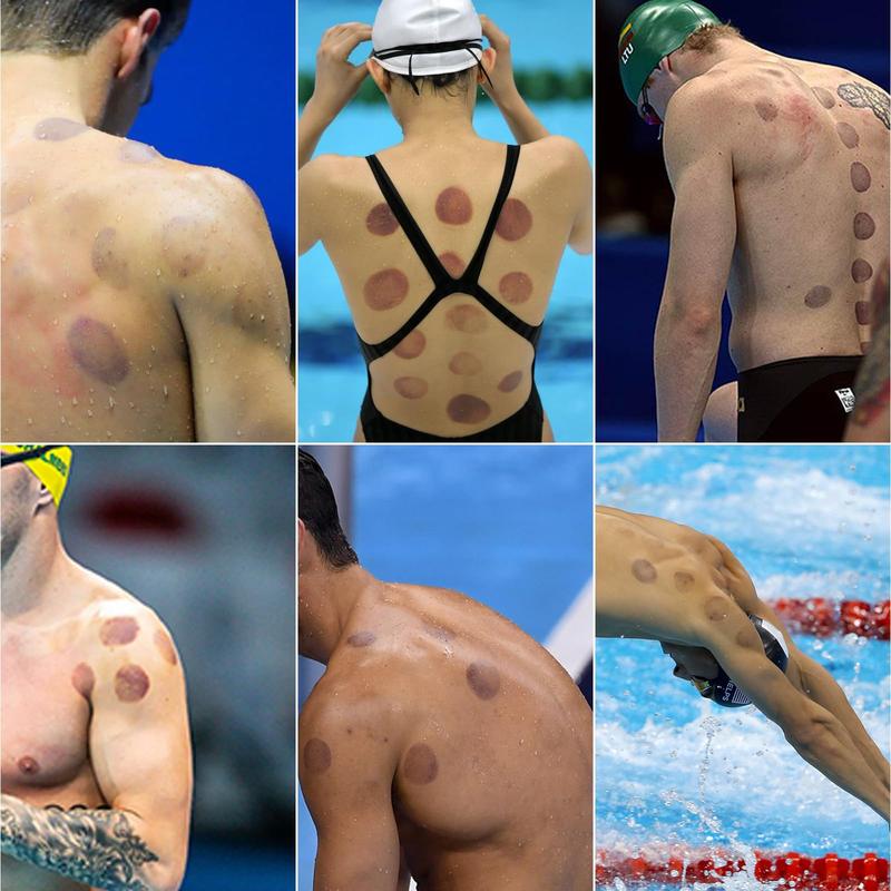 Pain Relief & Recovery Cupping Kit – 6 Pieces